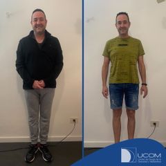 Bypass gástrico - Dr. Joan Pujol Rafols