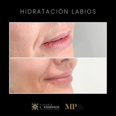 Hidratación de labios