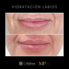 Hidratación de Labios