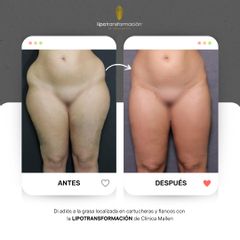 Clinica Mallen