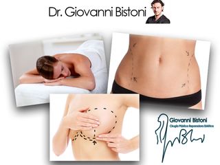 Dr. Giovanni Bistoni