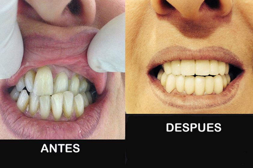 Ortodoncia antes y después - 491338