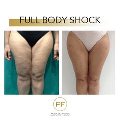 Full Body Shock - Dra. Pilar De Frutos