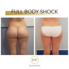 Full Body Shock - Dra. Pilar De Frutos