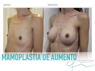 aumento Dra. Claudia Frigo