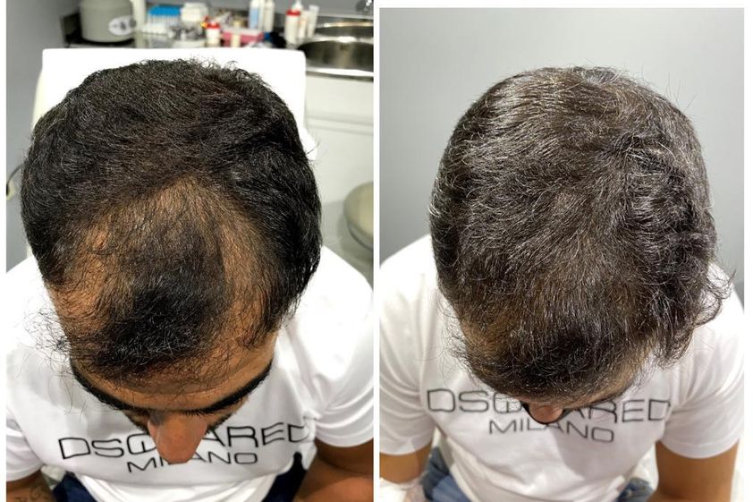 Tratamiento capilar antes y después - 792562