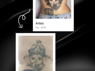 Eliminación de tatuajes antes y después - 880687