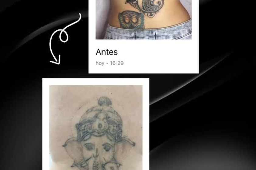 Eliminación de tatuajes antes y después - 880687