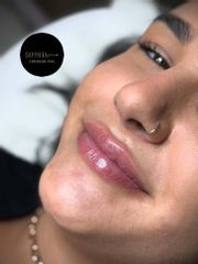Aumento de labios - Sapphira Privé Córdoba Vial