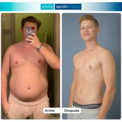 -27 kg con Balón Gástrico - Clínica Opción Médica