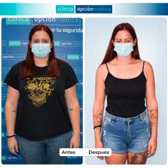 -25kg con Balón Gástrico - Clínica Opción Médica