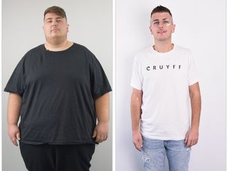 Manga gástrica antes y después - 876715