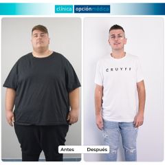 -150 kg con Cirugía Bariátrica - Clínica Opción Médica