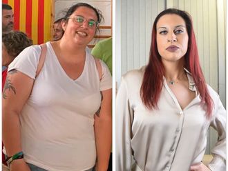 Manga gástrica antes y después - 876716