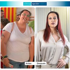-50 kg con Cirugía Bariátrica - Clínica Opción Médica