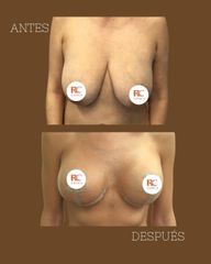 Rc Estética