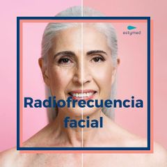 Radiofrecuencia Facial - Clínicas Estymed