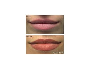Antes y después Micropigmentación labios