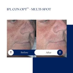 Ghorchi Clinic - IPL