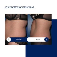 Ghorchi Clinic - Contorno corporal