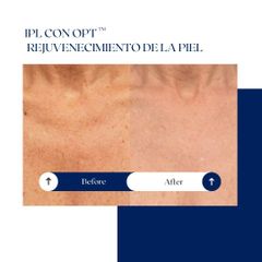 Ghorchi Clinic - IPL