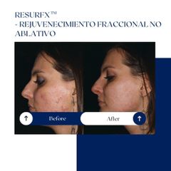 Ghorchi Clinic - Rejuvenecimiento