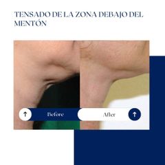 Ghorchi Clinic - Rejuvenecimiento