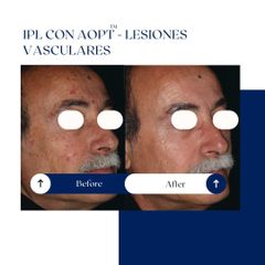 Ghorchi Clinic - IPL
