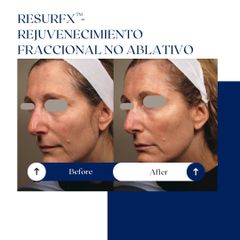 Ghorchi Clinic - Rejuvenecimiento