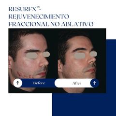 Ghorchi Clinic - Rejuvenecimiento