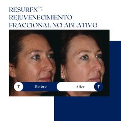 Ghorchi Clinic - Rejuvenecimiento
