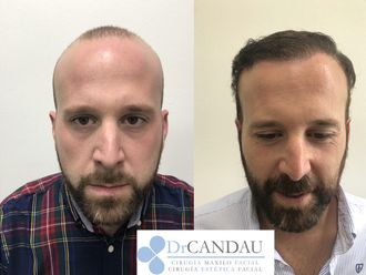 Tratamiento capilar - 641757