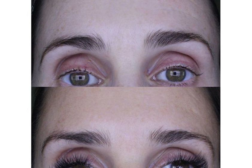Microblading antes y después - 650009