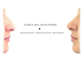 Rinoseptoplastia - 627433