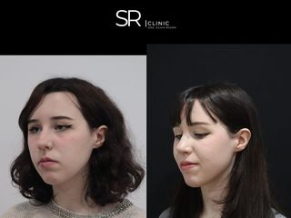 Cirugía maxilofacial - Clinica Silvia Roson