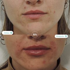 antes y despues - Doctores BenSan