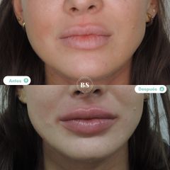 Labios - Doctores BenSan