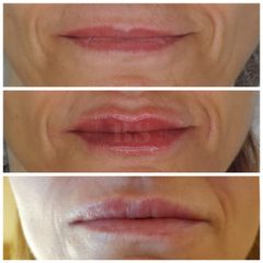 Labios - Doctores BenSan