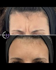 Dr. Eduardo Higbi - Rejuvenecimiento facial