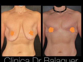 Cambio de sexo antes y después - 847716