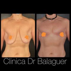 Cambio de sexo - Clinica Dr Balaguer