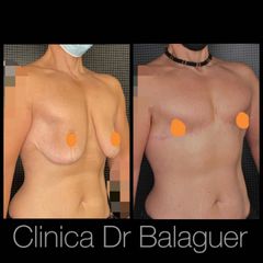 Cambio de sexo - Clinica Dr Balaguer