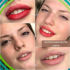 Micropigmentación - Dermatodesign