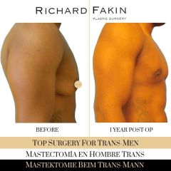 Cambio de sexo - Ocean Clinic Madrid