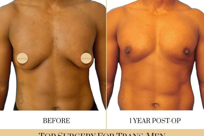 Cambio de sexo antes y después - 740312