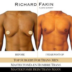 Cambio de sexo - Ocean Clinic Madrid