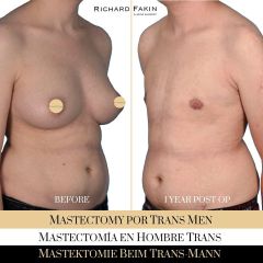 Cambio de sexo - Ocean Clinic Madrid