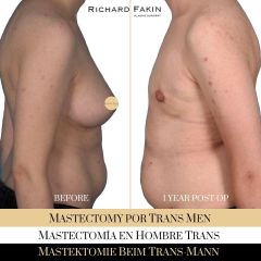 Cambio de sexo - Ocean Clinic Madrid