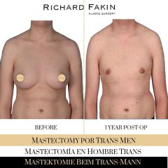 Cambio de sexo - Ocean Clinic Madrid