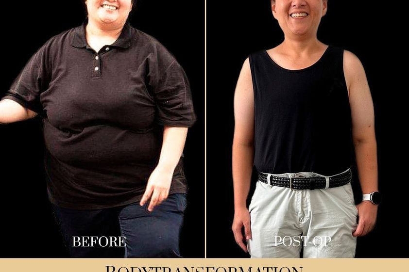 Cambio de sexo antes y después - 820567